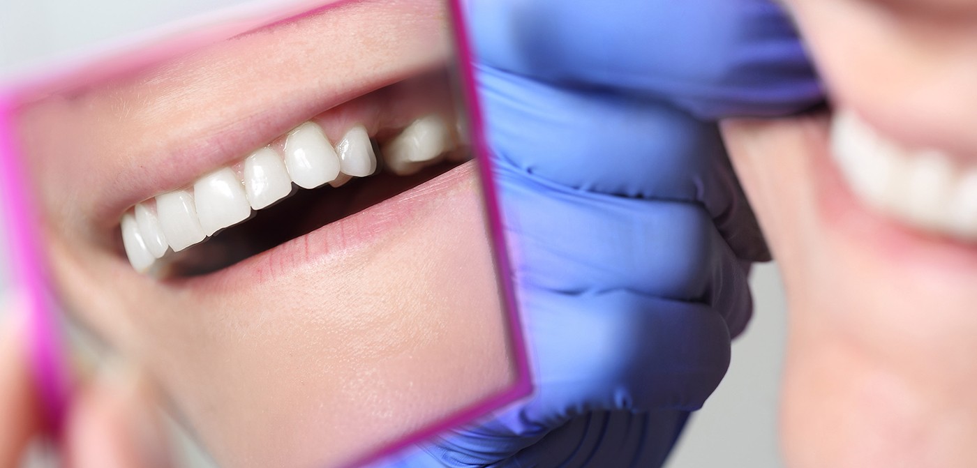 man showing missing tooth in mirror